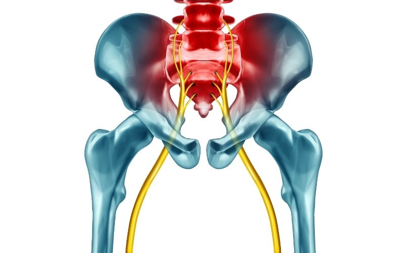 Sciatic nerve pain demonstration